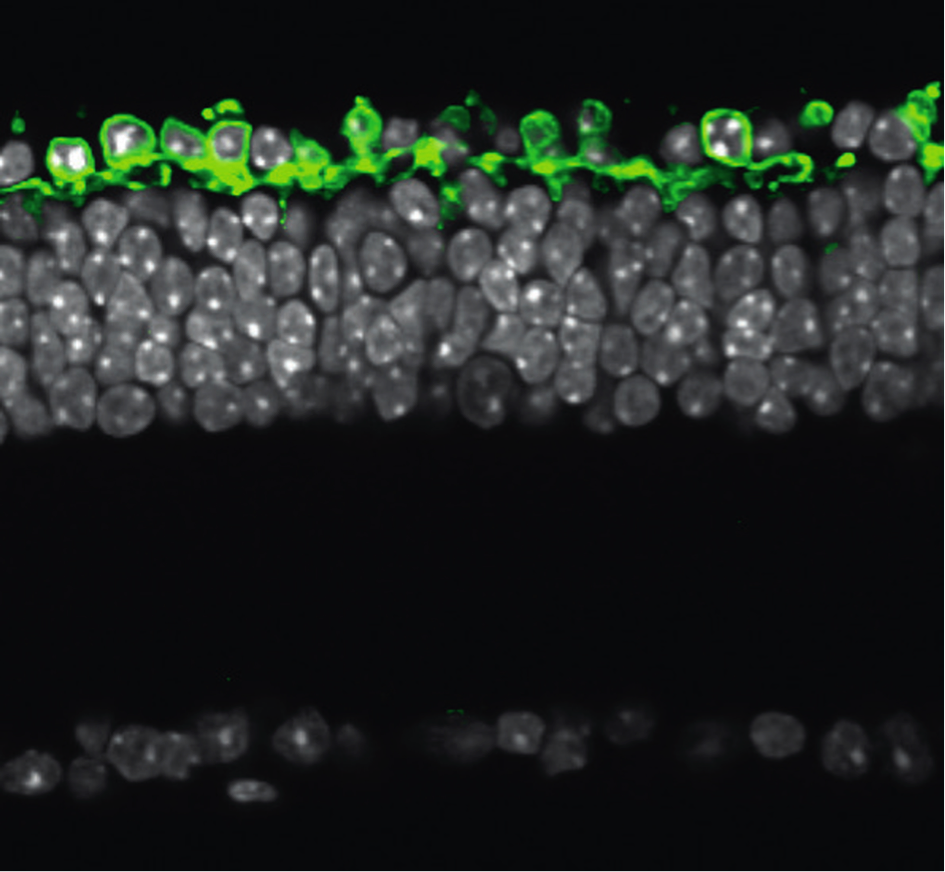 Cross section of a degenareted Retinitis pigmentosa retina. The genetically delivered light sensor is produced in the remaining outermost neural cell layer (green). In white, the nuclear layers of the retina.